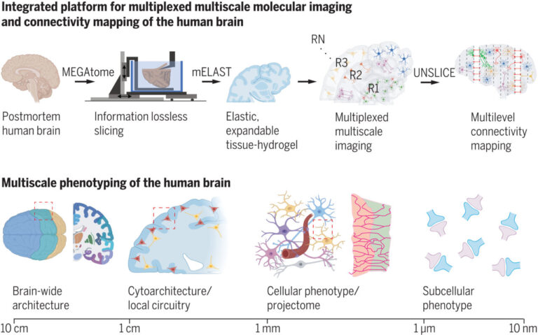 Revolucionaria plataforma para ver el cerebro como nunca antes